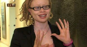 Direitos dos Albinos